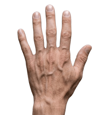 Left hand dorsal